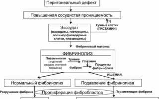 После цефтриаксона черный стул