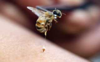 Что нужно делать при укусе пчелы?