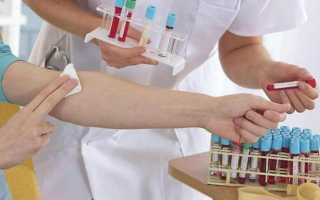 Mpv анализ крови расшифровка норма у женщин