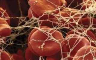 Биохимический анализ крови фибриноген норма