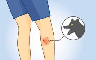 Что делать если укусила собака сильно до крови?